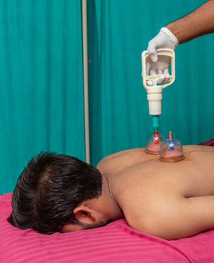 accupuncture image 2 smj ayurveda and wellness centre in vijay nagar indore